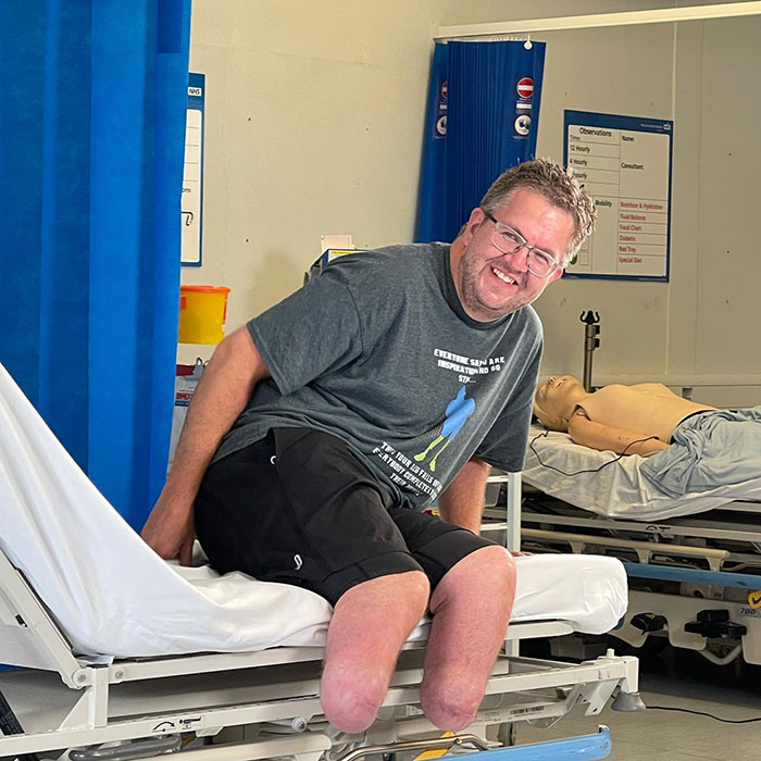 Man with amputated legs sitting on hospital bed smiling, related to surgeon who intentionally had own legs amputated case. Man with amputated legs sitting on hospital bed smiling, related to surgeon who intentionally had own legs amputated case.