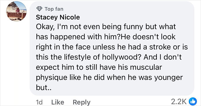 Facebook comment expressing concern about Simon Cowell's appearance after a bike accident, raising worry among fans.