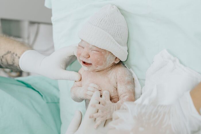 Newborn with a rare skin condition examined by doctors wearing gloves in a clinical setting.
