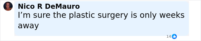 Comment by Nico R DeMauro saying the plastic surgery is only weeks away, related to North West dermal piercing controversy.