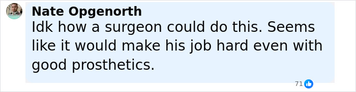 Comment from Nate Opgenorth expressing disbelief about a surgeon who intentionally amputated his own legs despite prosthetics. Comment from Nate Opgenorth expressing disbelief about a surgeon who intentionally amputated his own legs despite prosthetics.