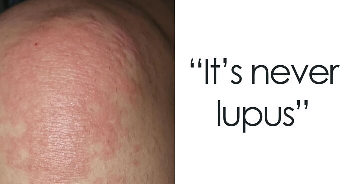 Doctors Weigh In On The 40 Times House M.D. Got It Totally Right Or Horribly Wrong