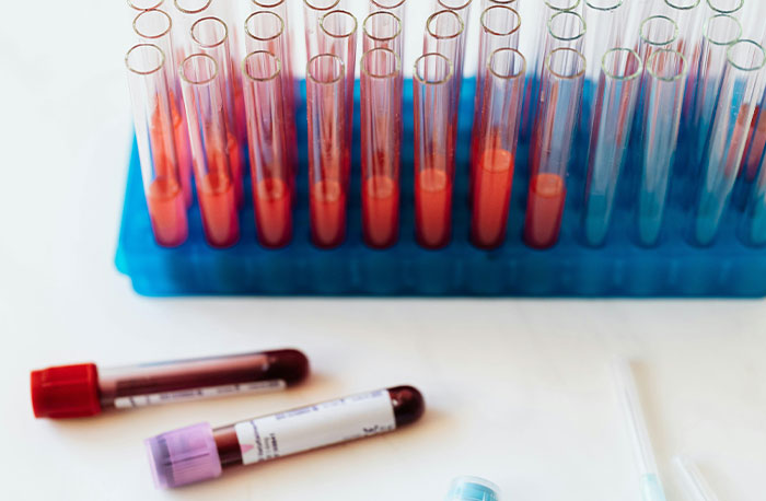 Blood samples in test tubes and vials laid out on a surface representing accurate medical diagnoses by doctors.