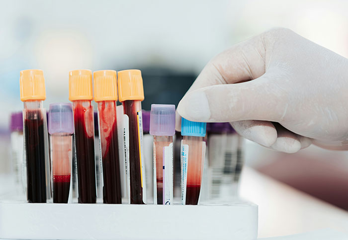 Gloved hand selecting blood sample vial among test tubes, illustrating investigation in missing person cases.
