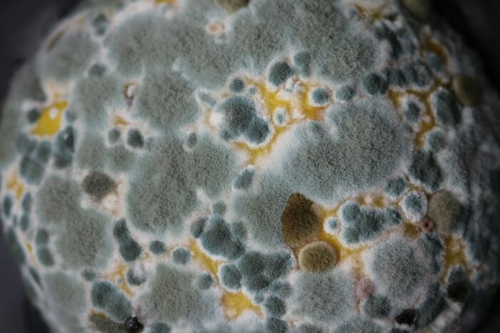 Close-up of mold spores representing rare disease symptoms often encountered by doctors in unusual patient cases.