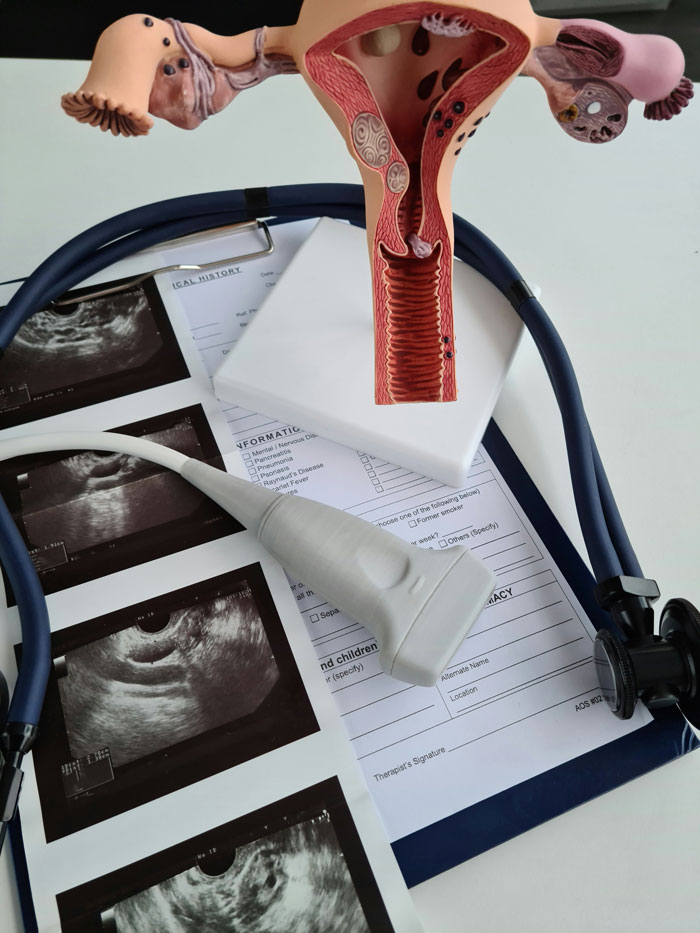 Model of female reproductive system with ultrasound scans, stethoscope, and medical forms for period diagnosis examination.
