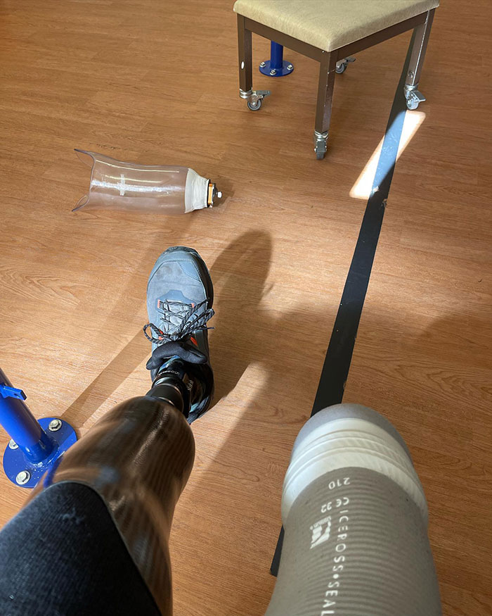 Person with prosthetic leg and shoe sitting on wooden floor near chair and empty prosthetic socket in medical setting Person with prosthetic leg and shoe sitting on wooden floor near chair and empty prosthetic socket in medical setting