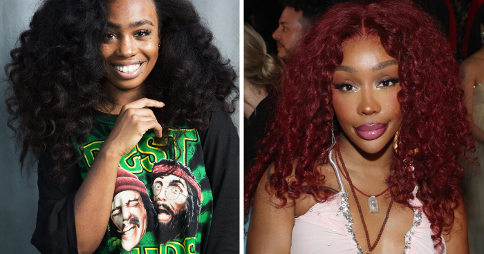 SZA’s “Before And After” Confessions And The Aftermath Of Cosmetic Transformation