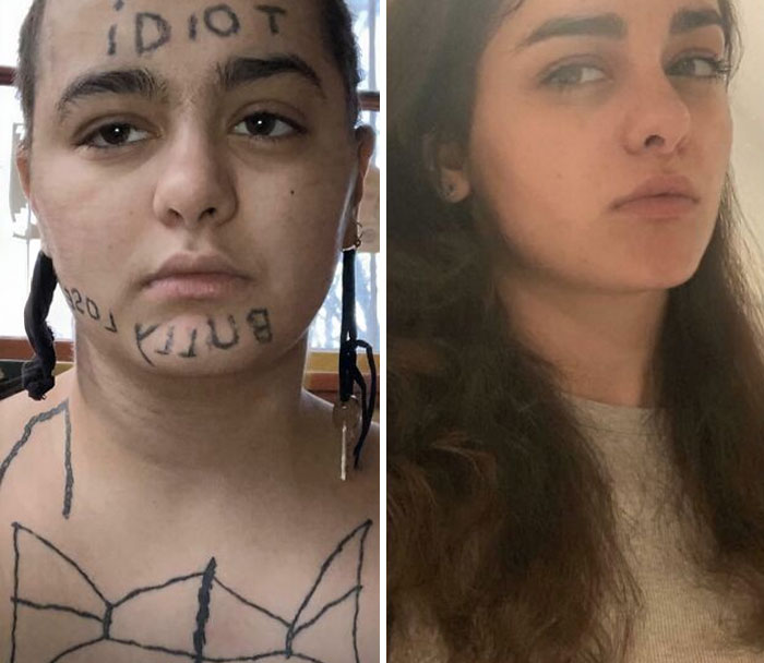 Before and after photos showing tattoo mistakes on a woman's face transformed with improved skin appearance.