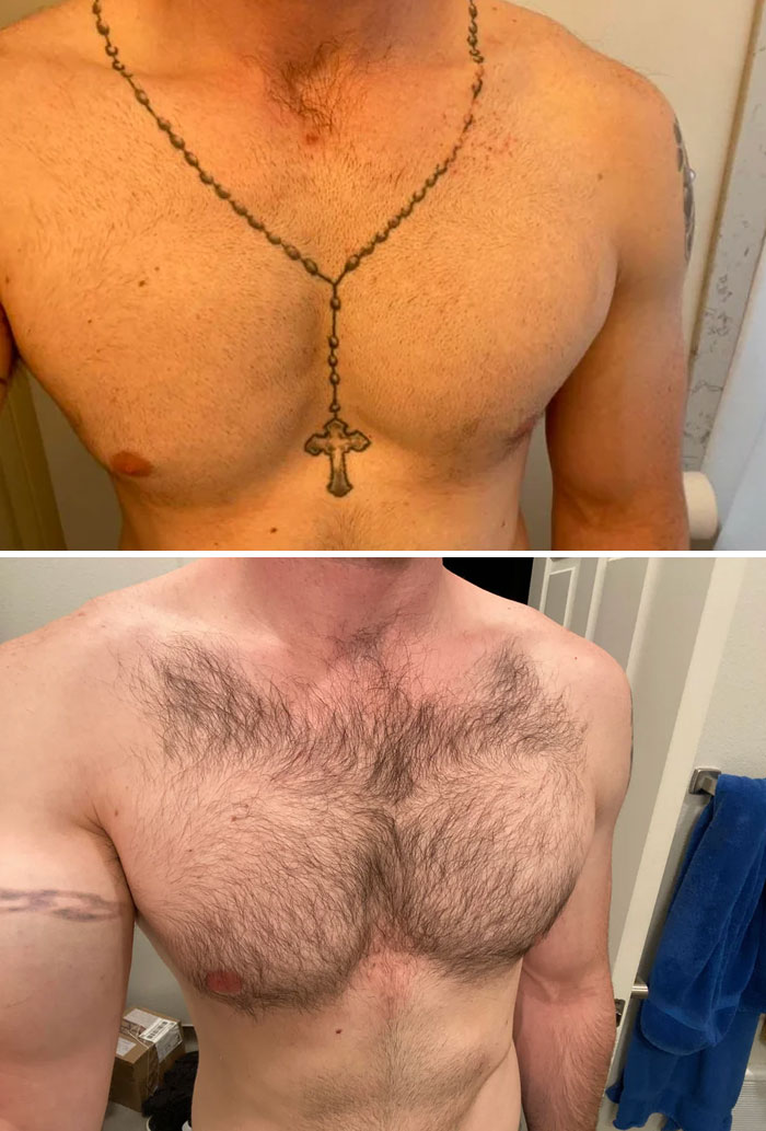 Before and after photos showing tattoo mistakes removed from a man's chest, highlighting tattoo mistake correction results.