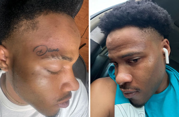 Before and after photos showing tattoo mistakes on the face and how they can be effectively removed or covered up.