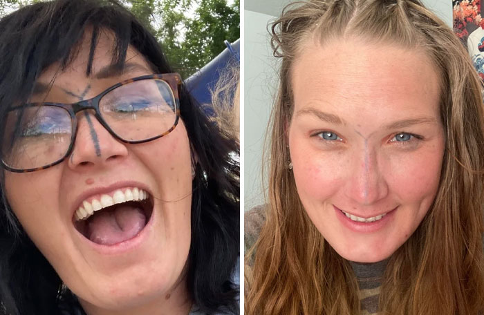 Before and after photos showing tattoo mistakes on noses and how they can be corrected effectively.