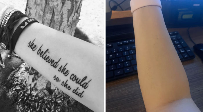 Before and after photos showing tattoo mistakes corrected, highlighting modern tattoo removal and cover-up results.