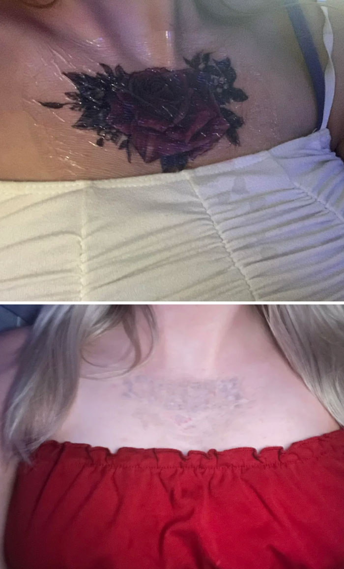 Before and after photos showing tattoo mistakes fading and removal progress on chest area of two people.