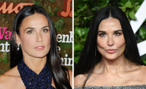 29 Celebrities Fans Believe Ruined Their Beauty With Buccal Fat Removal