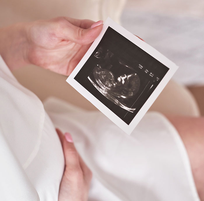 Pregnant woman holding ultrasound photo, illustrating a woman calling out MIL for hijacking pregnancy on Facebook.