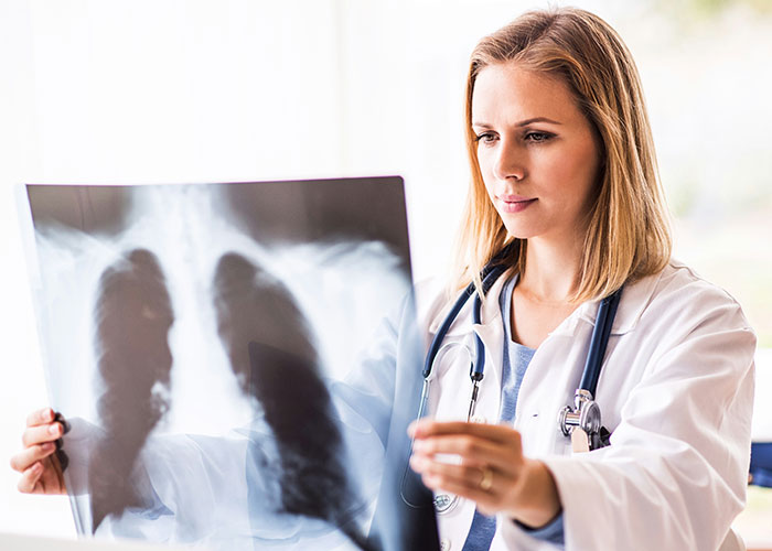 Female doctor examining a chest X-ray, illustrating weird body quirks that prove the human body is fascinating.