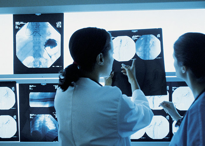 Two medical professionals examining body X-rays, illustrating weird body quirks and fascinating human body traits.