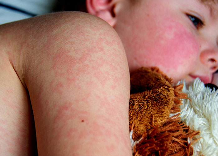 "I Had Nightmares For A Year": 41 Vacations That Ended Up Being More Like Trips To Hell