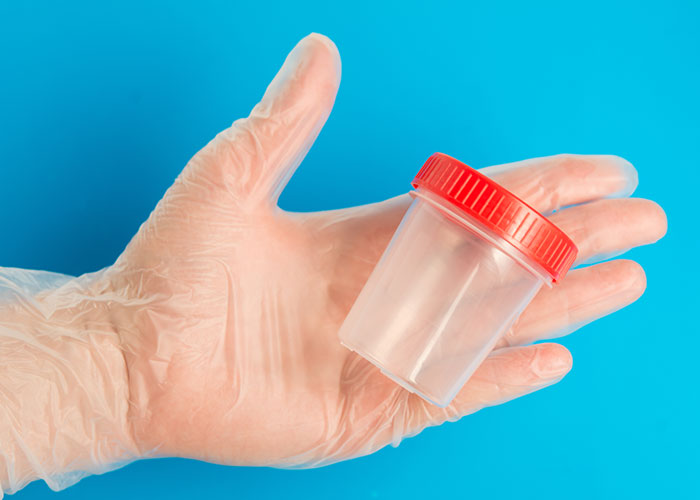 Hand in disposable glove holding a small plastic container with red lid against a blue background, wildest rules concept.