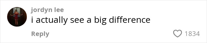 Comment on social media post showing text i actually see a big difference about woman’s Kybella face transformation viral recovery phase. Comment on social media post showing text i actually see a big difference about woman’s Kybella face transformation viral recovery phase.