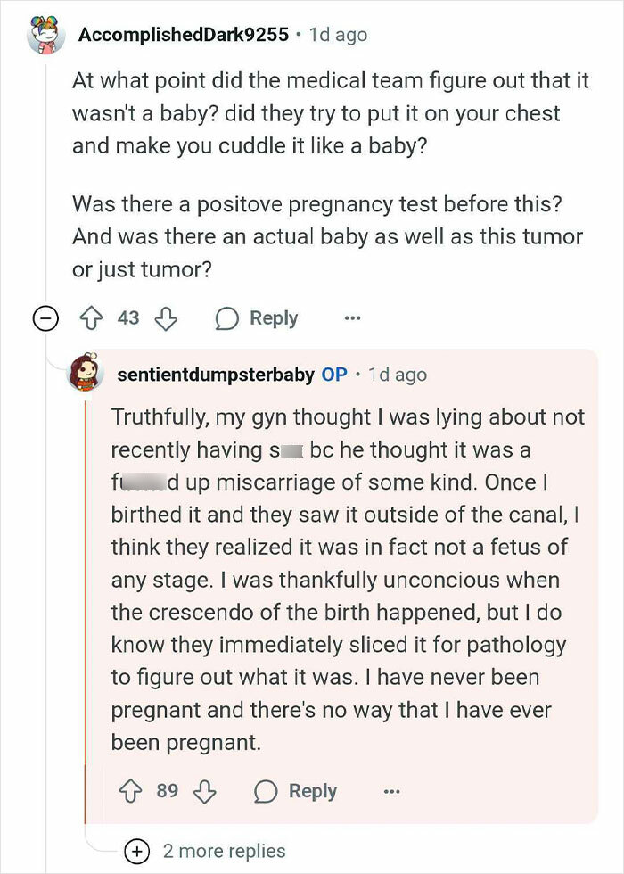 Reddit user shares experience of thinking she was pregnant but gave birth to a tumor, answering community questions.