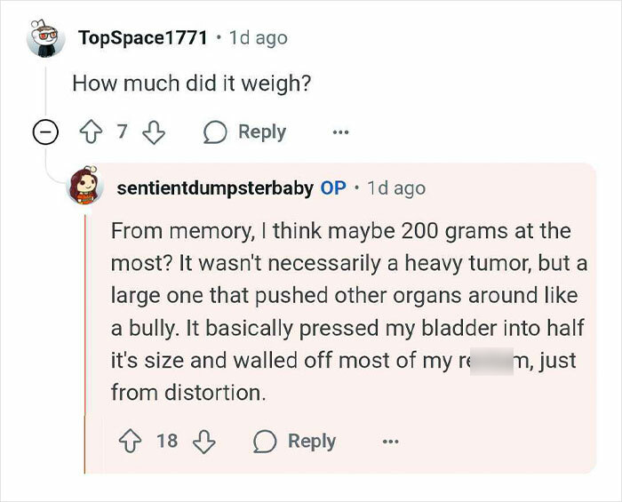 Reddit comment exchange discussing the weight and impact of a tumor mistaken for pregnancy symptoms.
