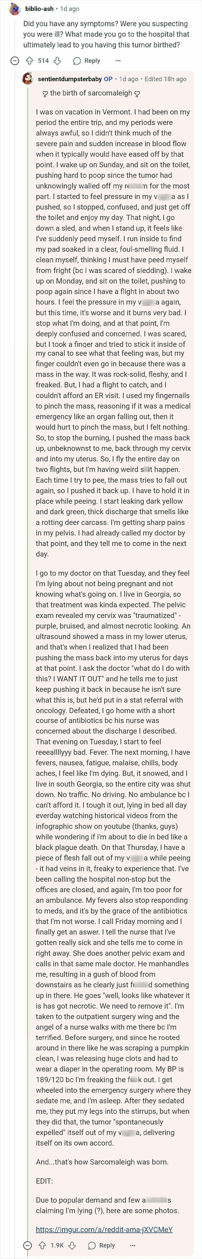 Woman thinks she's pregnant but gives birth to a tumor instead, describing medical journey and diagnosis of sarcomaleigh.