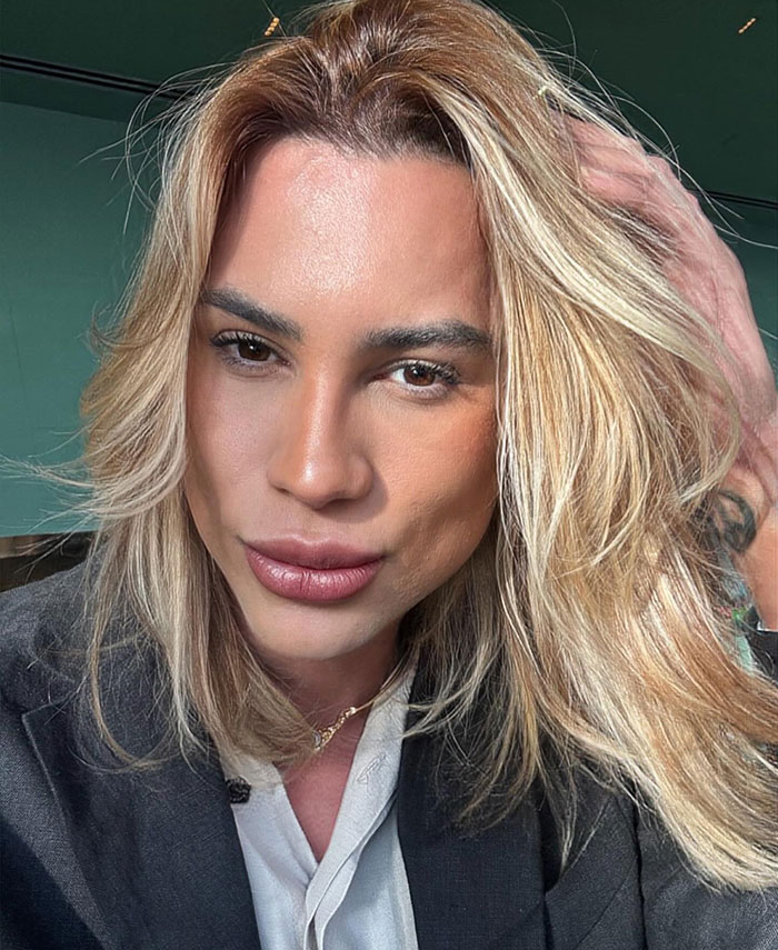 Influencer with blonde hair posing indoors, highlighting complications from popular Fox Eyes surgery procedure.