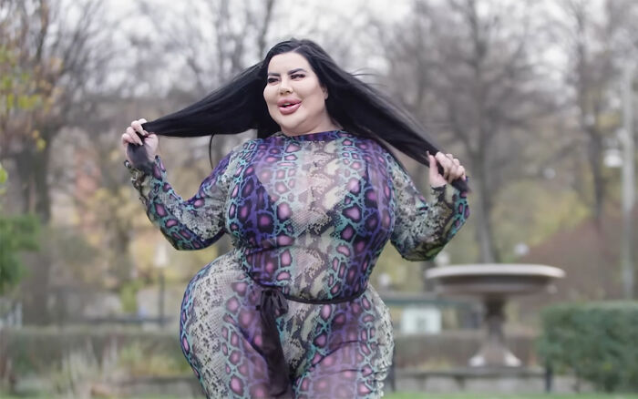 Plastic surgery enthusiast posing outdoors wearing a patterned outfit, highlighting dramatic body enhancements and transformation.