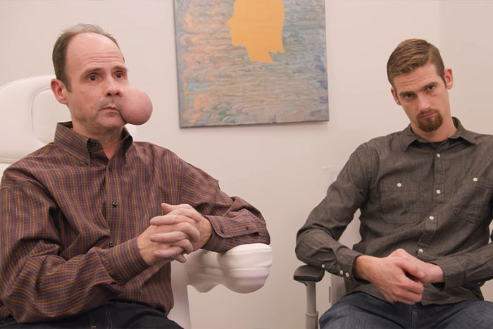 Man with 4-lb face tumor sitting in a clinic with another man, seeking urgent medical help amid fatal doctor warning.