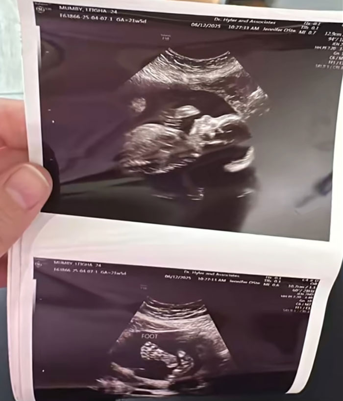 Ultrasound images of a fetus being held, related to Florida dad-to-be's story before passing. Ultrasound images of a fetus being held, related to Florida dad-to-be's story before passing.