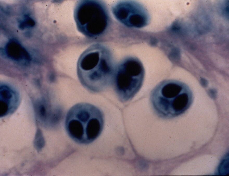 Microscopic view of some of the smallest animals in the world showing detailed cellular structures and shapes.