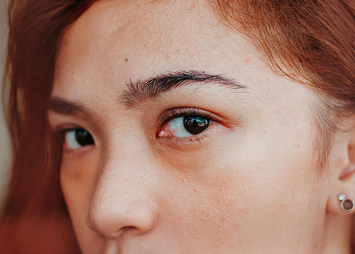 Close-up of a woman's face showing natural skin texture and subtle imperfections after a cosmetic procedure regret moment.