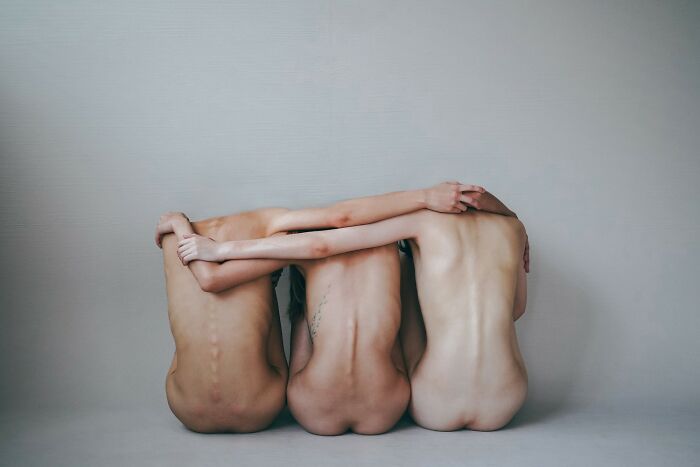 Three n**e figures sitting side by side with arms around each other, featured in award-winning 2025 photography contest.