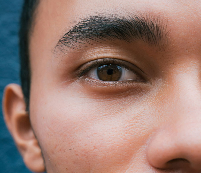 Close-up of a young man's face showing clear skin and detailed eye, related to plastic surgeons and unnecessary surgeries.