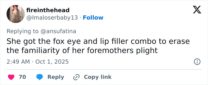 Tweet discussing Emma Stone's Louis Vuitton photos sparking plastic surgery speculation about fox eye and lip fillers.