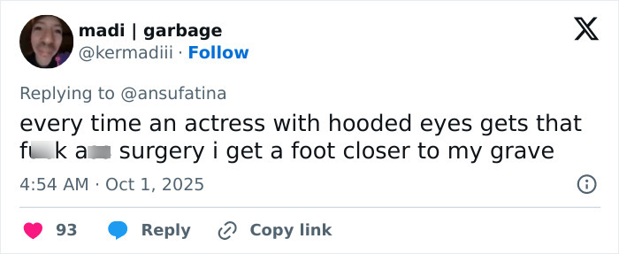 Tweet criticizing actresses with hooded eyes and referencing plastic surgery speculation amid Emma Stone Louis Vuitton photos frenzy.