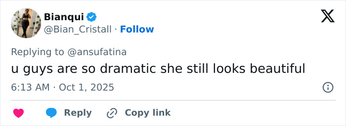 Twitter reply from Bianqui defending Emma Stone&rsquo;s appearance amid Louis Vuitton plastic surgery speculation frenzy.