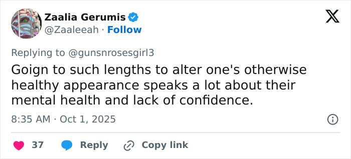 Tweet discussing the mental health impact of risky eye color change surgery risking blindness by an actress.