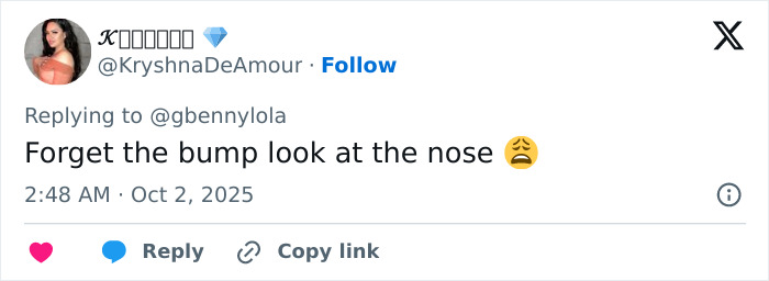 Zendaya fans react to viral photo with Lisa, speculating she might be pregnant based on her face and nose features.