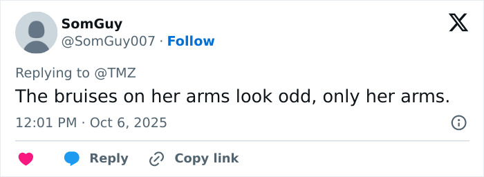 Tweet showing concern about Britney Spears bruises after a horrible accident claim, focusing on bruises on her arms.