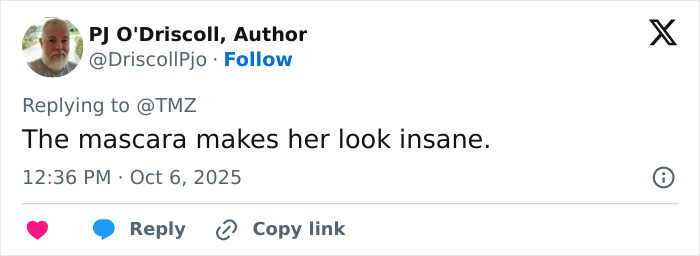 Tweet screenshot showing a user commenting on Britney Spears' appearance with bruises after a concerning accident claim.