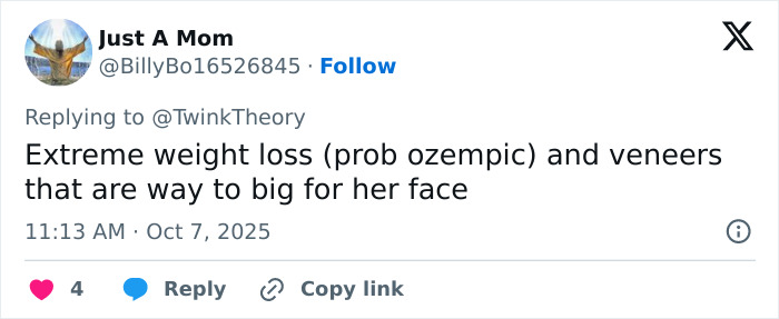 Tweet screenshot discussing Mandy Moore's unrecognizable new look with weight loss and oversized veneers.