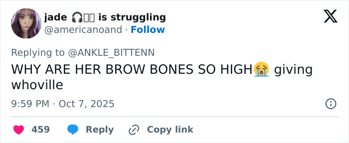 Tweet discussing high brow bones, with Taylor Swift fans calling out cosmetic procedures after viral interview about MAGA transformation. Tweet discussing high brow bones, with Taylor Swift fans calling out cosmetic procedures after viral interview about MAGA transformation.
