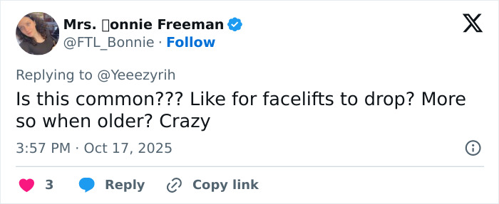 Fan tweet reacting with surprise to Kris Jenner&rsquo;s latest public appearance and discussing facelift results with age.