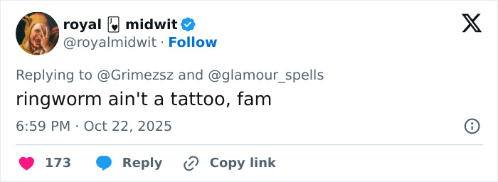 Tweet screenshot showing a user commenting on ringworm, clarifying it is not a tattoo.