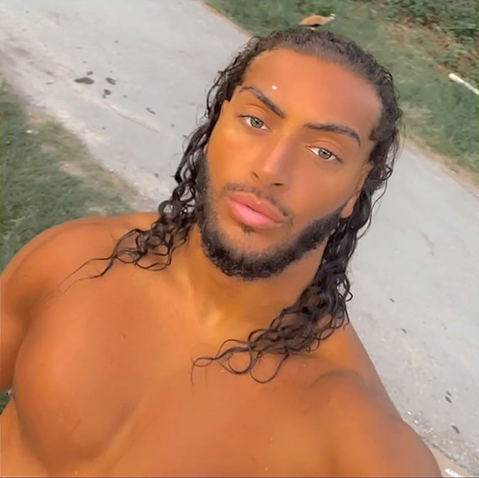 Young male influencer with long curly hair posing shirtless outdoors, related to fake syringe attack pranks controversy.