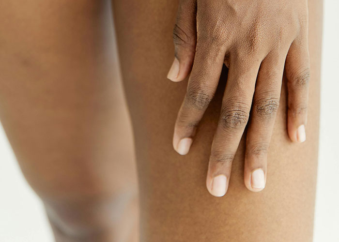 Close-up of a hand resting on bare skin, illustrating natural appearance before a cosmetic procedure.