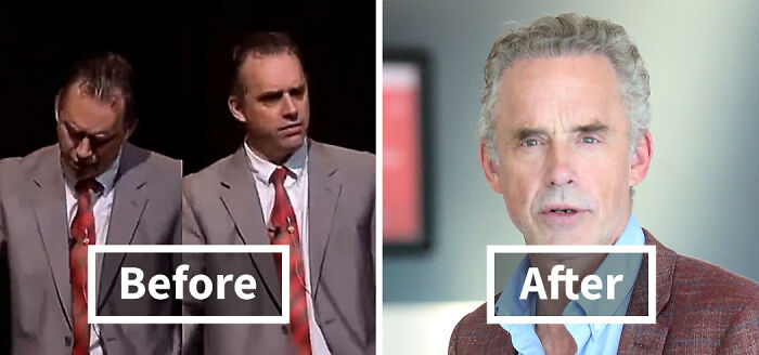 Before and after photos of a man showing noticeable improvement after hair transplant in a professional setting.